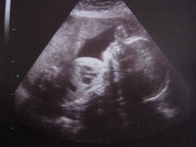 Bild zu Zurück vom FA - Forum für November - Mamis