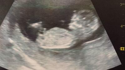 Bild zu Hallo ihr Süßen - Forum für November - Mamis