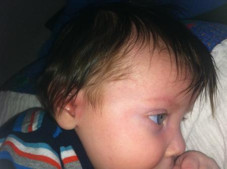 Bild zu