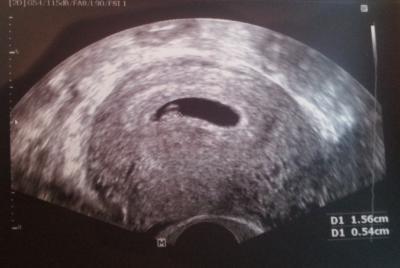 Bild zu 1. Foto :-) - Forum für November - Mamis