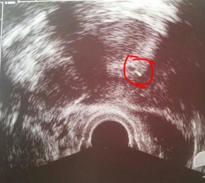 Bild zu alles gut - und mein erstes foto - Forum für November - Mamis
