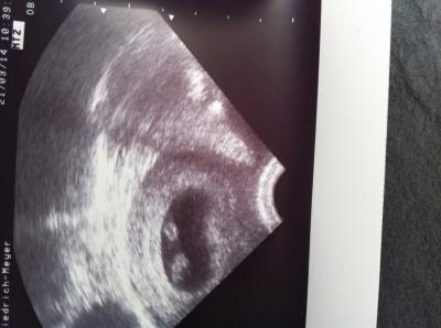 Bild zu Hebammentermin! - Forum für November - Mamis