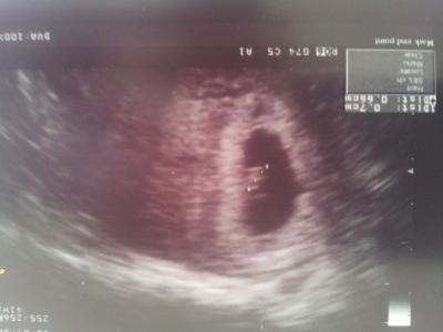 Bild zu Bin auch zurück - Forum für November - Mamis