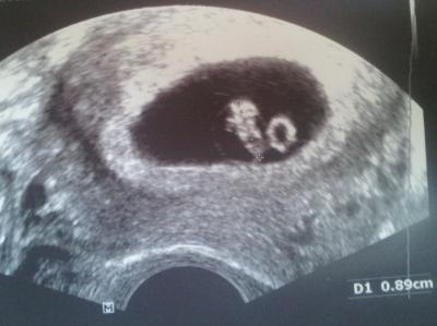 Bild zu Alien-Hase - Forum für November - Mamis
