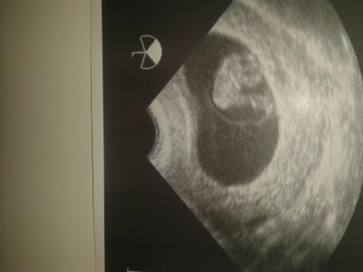 Bild zu Zurück vom Doc !!! - Forum für November - Mamis