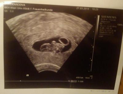 Bild zu letzte Kontrolle in der Kiwu, KH und SSW - Forum für November - Mamis