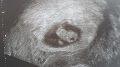 Bild zu Zurück vom FA - gemischte Gefühle :( - Forum für November - Mamis