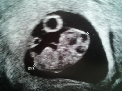 Bild zu Der kleinen Krabbe geht es gut :-) - Forum für November - Mamis