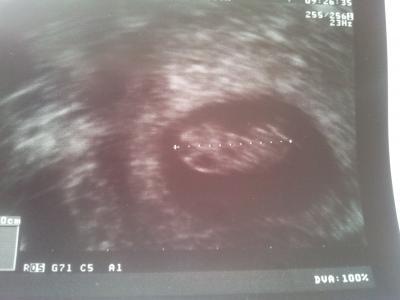 Bild zu Zurück und happy! - Forum für November - Mamis