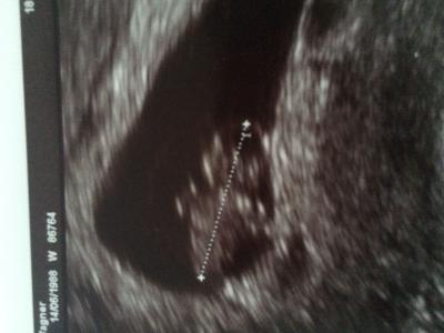 Bild zu Außerplanmäßig bei Arzt gewesen!!! - Forum für November - Mamis