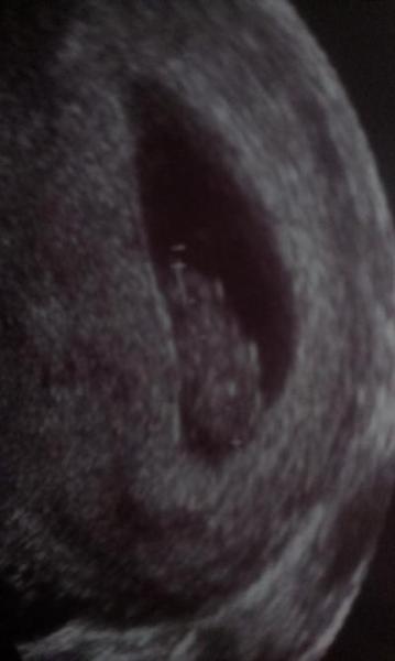 Bild zu :-) - Forum für November - Mamis