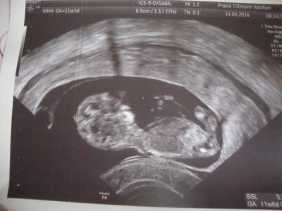Bild zu Unser Kleines ist ein(e) Tänzer(in) :D - Forum für November - Mamis