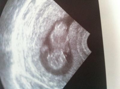 Bild zu 😇😇😇 juhu👼👼👼 - Forum für November - Mamis