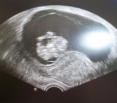 Bild zu News vom FA :) - Forum für November - Mamis
