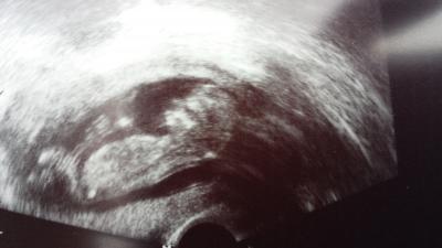 Bild zu Nachtrag zum gestrichen FA-Besuch :=) - Forum für November - Mamis