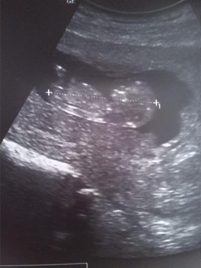 Bild zu 12. Woche und es ist immer noch alles in Ordnung!!!!!! - Forum für November - Mamis