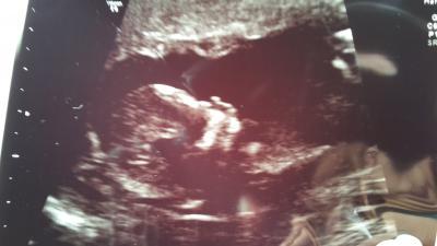 Bild zu Hatte gestern Gyn Termin - Forum für November - Mamis