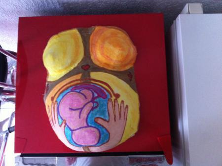 Bild zu