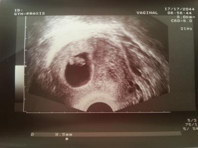 Bild zu kurzes update von mir - Forum für November - Mamis