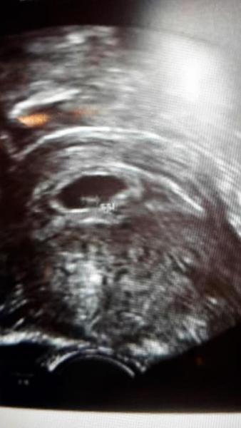 Bild zu Zurück vom Gyn - Forum für November - Mamis