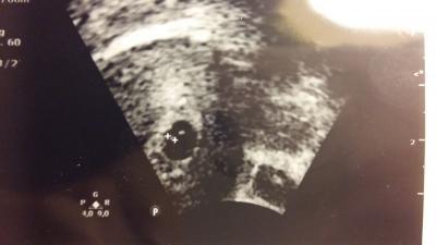 Bild zu Hilfe!!! Baby zu klein :'( - Forum für November - Mamis