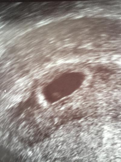 Bild zu Neu hier 😊 - Forum für November - Mamis