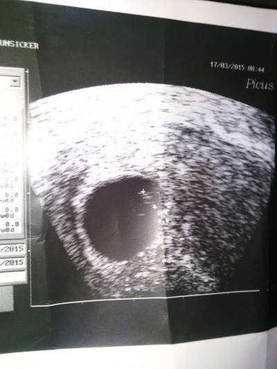 Bild zu arzt termin heute:) - Forum für November - Mamis