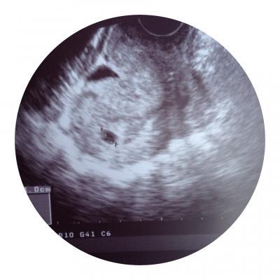 Bild zu Erster FA Termin heute :-) - Forum für November - Mamis
