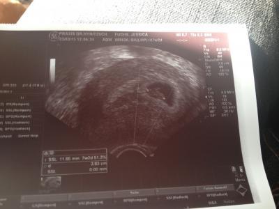 Bild zu Zurück vom FA - Forum für November - Mamis