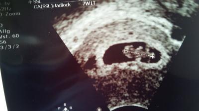 Bild zu zurück vom FA :) - Forum für November - Mamis