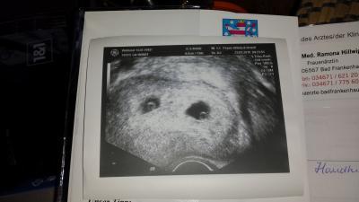 Bild zu fa besuch - Forum für November - Mamis