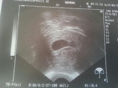 Bild zu zurück vom fa - Forum für November - Mamis