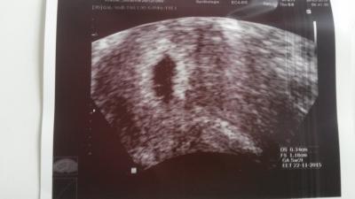 Bild zu zurück vom FA - Forum für November - Mamis