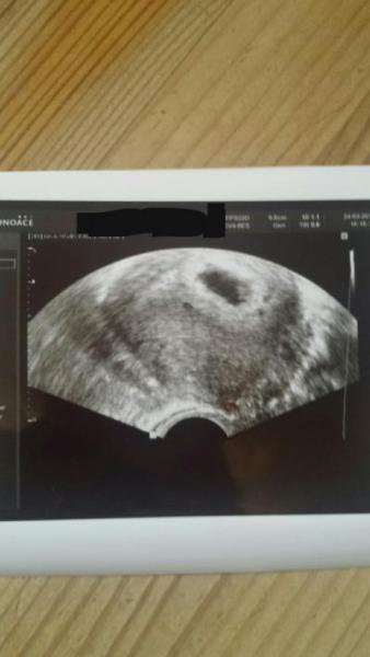 Bild zu auch zurück vom Frauenarzt - Forum für November - Mamis