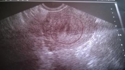 Bild zu Möchte euch auch mal mein Bildchen zeigen :-) - Forum für November - Mamis