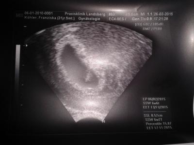 Bild zu 1.termin fa - Forum für November - Mamis