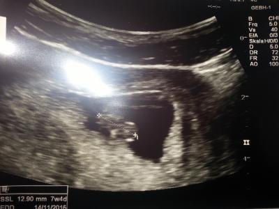 Bild zu zurück vom Arzt und schon wieder Sorge - Forum für November - Mamis
