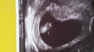 Bild zu Zurück vom FA - Forum für November - Mamis