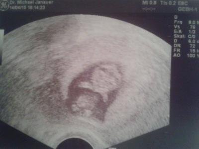 Bild zu FA heute ;) - Forum für November - Mamis
