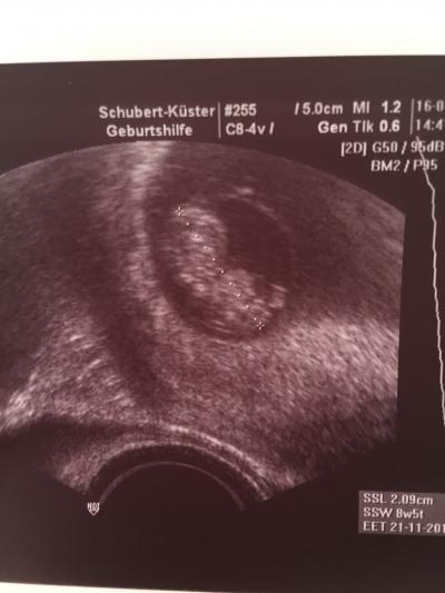 Bild zu Außerplanmäßig zur FA.. - Forum für November - Mamis