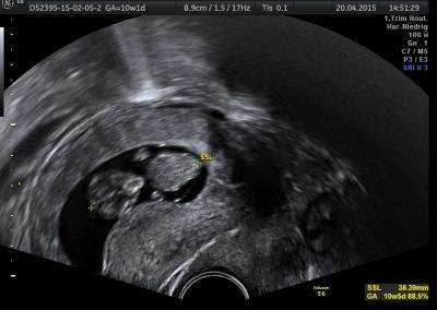 Bild zu Klinik heute ;) - Forum für November - Mamis