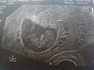 Bild zu frauenarztbesuch - Forum für November - Mamis