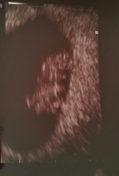 Bild zu Fa Termin :) - Forum für November - Mamis