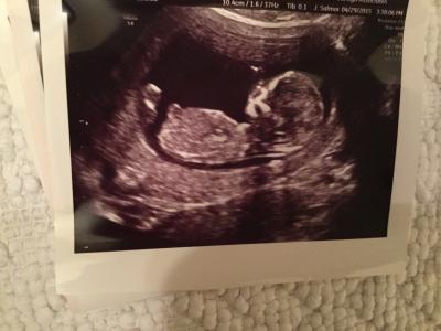 Bild zu FA Termin heute und OUTING! - Forum für November - Mamis