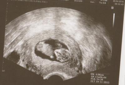 Bild zu zurück vom FA - Forum für November - Mamis
