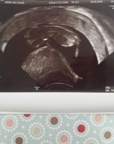 Bild zu FA Termin + Bild - Forum für November - Mamis