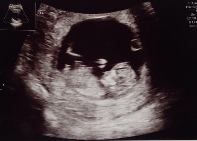 Bild zu Heutiger FA-Termin :) - Forum für November - Mamis