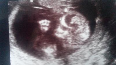 Bild zu Hebamme und NFM - Forum für November - Mamis
