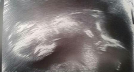 Bild zu Nicht mein Tag:-( - Forum für November - Mamis