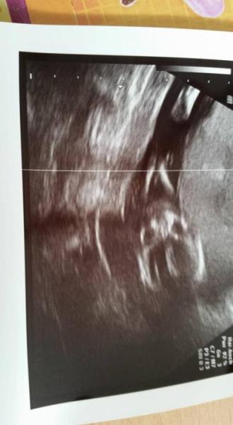 Bild zu heutiger FA-Termin - Forum für November - Mamis